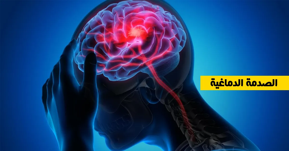 الصدمة الدماغية